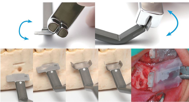 KimTrac i bruk. Foto.